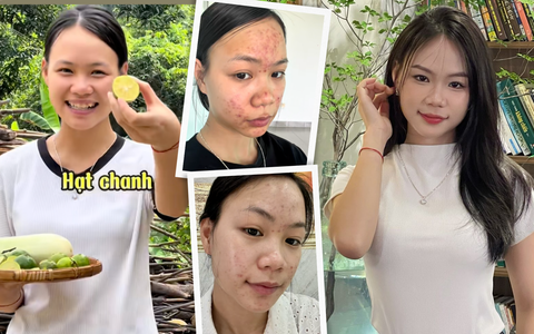 Da chi chít mụn do 5 năm rửa mặt sai cách, cô nàng chữa lành làn da bằng loại hạt mà mọi người vứt bỏ