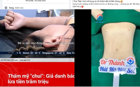 Hút mỡ nội soi bởi bác sĩ "công nhân đóng gạch" khiến nhiều chị em khóc ngất: Làm đẹp không sai nhưng đừng dại giao cho cơ sở thẩm mỹ trái phép!