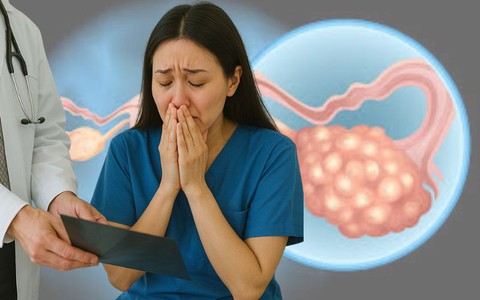 Tự hào về sức khỏe của mình, nhưng tôi đã bị sốc khi biết minh bị ung thư buồng trứng ở tuổi 40: 2 dấu hiệu cảnh báo đã bị tôi bỏ qua