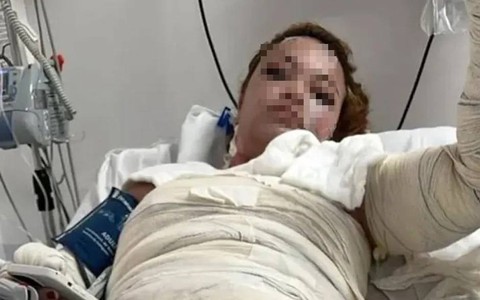 Người phụ nữ bỏng nặng, tử vong sau khi tắm nước nóng trong nhà nghỉ