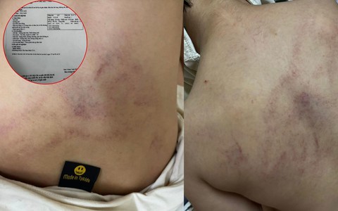 Vụ bé 4 tuổi bị giáo viên đánh, ném vào tường ở Hà Nội: Người mẹ tiết lộ câu nói gây sốc