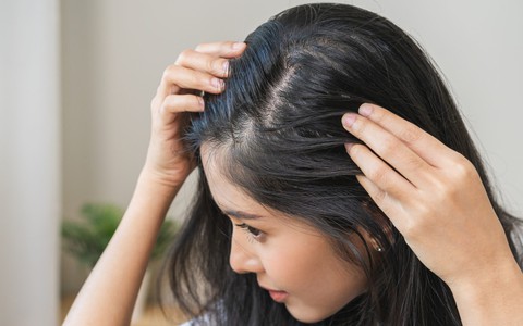 Viên uống chống già giúp xóa nếp nhăn nhưng gây rụng tóc khi dùng sai liều lượng
