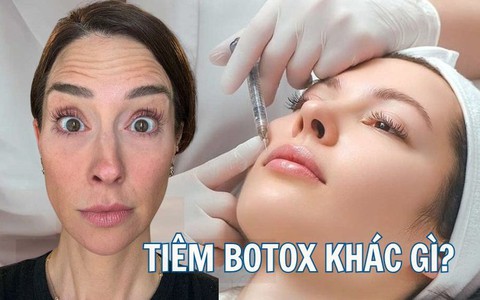 Tiêm botox vào một nửa khuôn mặt để xem ảnh hưởng thế nào đến vẻ bề ngoài: Nữ y tá "gây sốt" khi hé lộ kết quả!