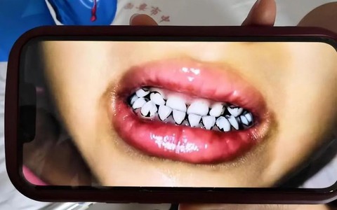 233 trẻ mầm non ở Thiên Thủy nhiễm độc chì nặng: Lộ tẩy sự thật kinh hoàng về nguyên liệu làm bánh