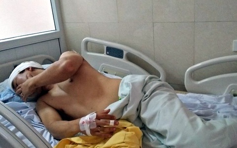 Hà Nội: Côn đồ mang hung khí truy sát người tại chung cư cao cấp