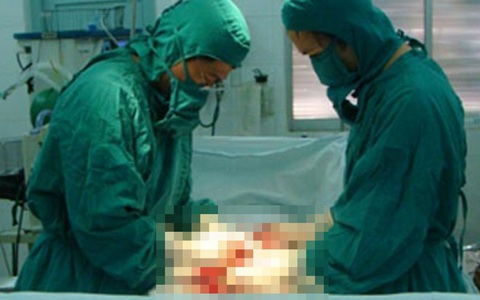 Bị phù nề, nhiễm trùng dương vật vì… xài bao cao su “dỏm”