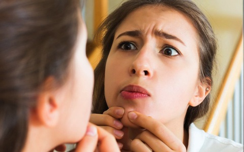 Bác sĩ “nặn mụn” nổi tiếng nhất thế giới tiết lộ 9 nguyên tắc xử lý mụn ai cũng nên nhớ kỹ
