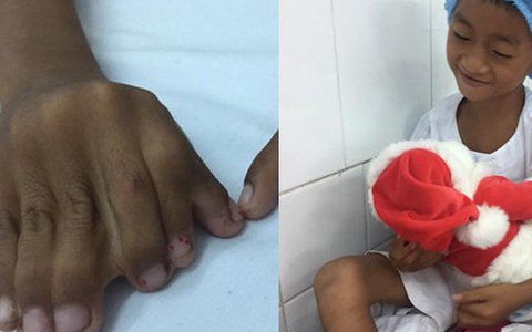 Quà giáng sinh đến sớm với cậu bé không thể đến trường vì “đôi bàn tay ếch” kỳ dị