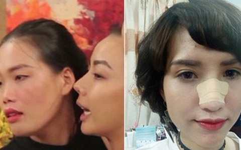 Lộ nghi án Hồng Xuân rời Next Top là vì bị đánh gãy mũi tại nhà chung