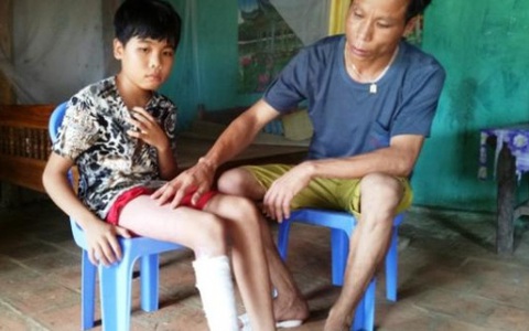 Cháu bé bị hổ vồ mất bắp chân đối mặt nhiều di chứng nặng nề