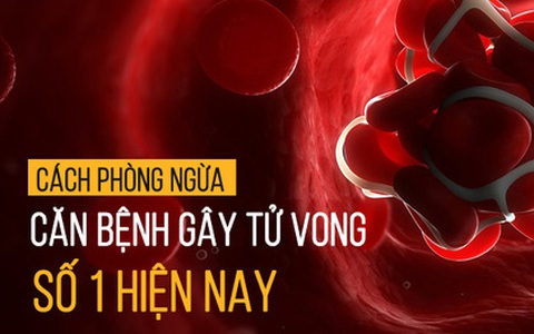 Căn bệnh trăm nghìn người chết mỗi năm ở VN: Không phải ung thư, Trung Quốc đang cảnh báo