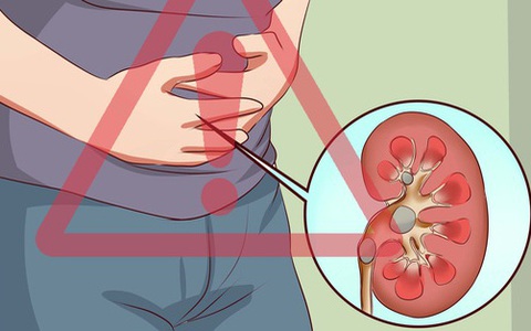 Đây là những hành động phá hủy thận từng ngày có thể bạn vô tình mắc mà không biết