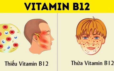 Dù bạn có nhu cầu bổ sung vitamin hay không thì cũng nên biết tất cả những thứ có liên quan đến vitamin như này