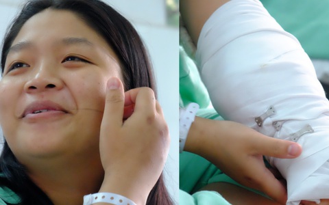 Cô gái bị máy cắt giấy chém lìa cánh tay: Bạn trai sắp cưới túc trực bên giường bệnh, xin cơm từ thiện cho ăn