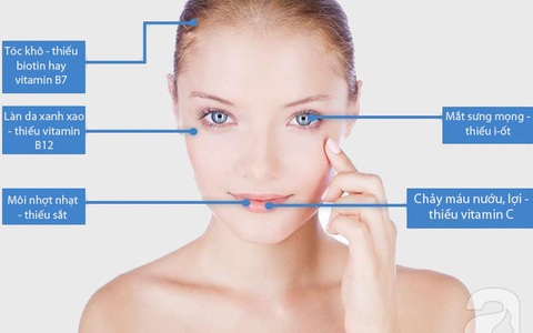 5 dấu hiệu trên mặt tố cáo bạn đang thiếu vitamin trầm trọng
