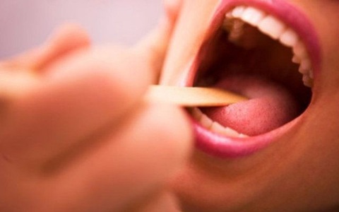 Dấu hiệu của viêm amidan bạn nhất định không được bỏ qua để tránh biến chứng nguy hiểm