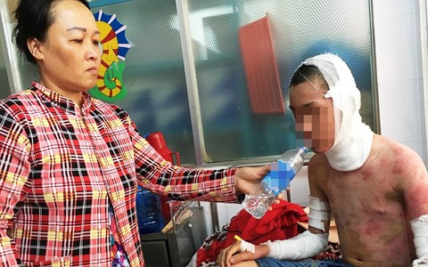 Nước mắt người mẹ bỏ việc lên Sài Gòn chăm con bị bỏng cồn nặng: "Tôi sắp bị công ty cắt hợp đồng"
