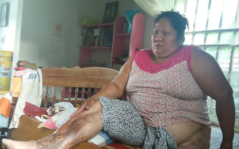 Gặp lại người mẹ đơn thân bị đứt lìa, dập nát hai chân sau vụ sập mỏ đá khiến 3 người chết, 7 người nguy kịch