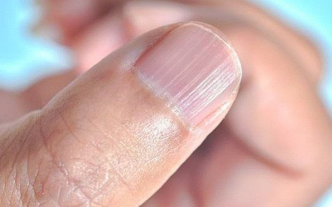 Giải mã 7 dấu hiệu bệnh lý thường thể hiện ra bên ngoài cơ thể
