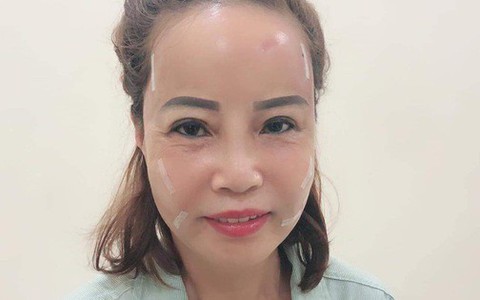 Tiết lộ sốc của cô dâu 62 lấy chồng 26 tuổi về diện mạo mới như thiếu nữ 18