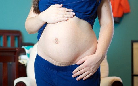 Mẹ sinh mổ không thể bỏ qua các bí quyết giúp vết mổ chóng lành sau khi sinh