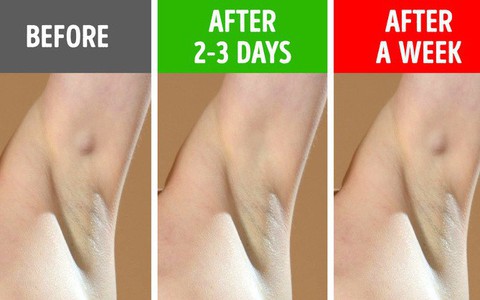 Đừng cố tình bỏ qua 6 biểu hiện ở nách vì nó có thể chỉ ra bệnh tiềm ẩn, không ngoại trừ ung thư