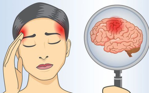 3 điều bạn có thể làm ngay bây giờ để bảo vệ bộ não tránh khỏi nguy cơ mất trí nhớ