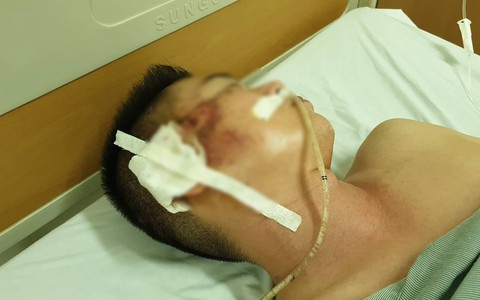 Đã xác định được đối tượng nổ súng bắn rồi chèn qua người tài xế taxi ở Hà Nội
