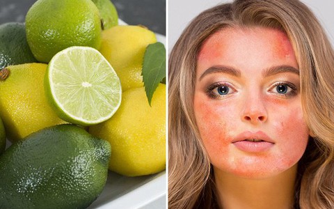 9 nguyên liệu nhiều chị em cứ tưởng an toàn mà lại vô cùng tai hại với da mặt