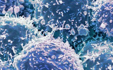 Chế tạo thành công loại virus chuyên diệt tế bào ung thư