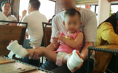 Cơ sở giữ trẻ lên tiếng việc bé gái 18 tháng tuổi bị phỏng ở chân: Không ai nhúng chân bé vào nước sôi