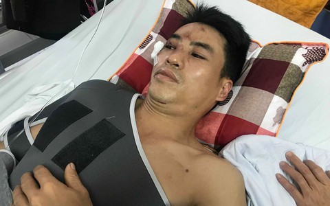 Vụ nữ tài xế Lexus tông hàng loạt xe ở Hà Nội: "Nhìn thấy xe đang lao đến nhưng tôi không kịp tránh"