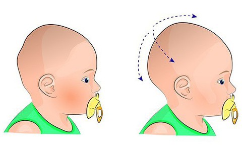 7 dấu hiệu bất thường ở trẻ sơ sinh, bố mẹ đừng chần chừ mà hãy đưa bé đi khám ngay 