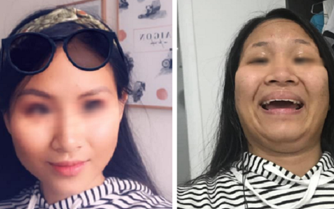 Đăng ảnh trước và sau chỉnh sửa, cô gái tự dìm mình để chứng minh: Dù mắt tinh cũng đừng tin ảnh gái trên mạng