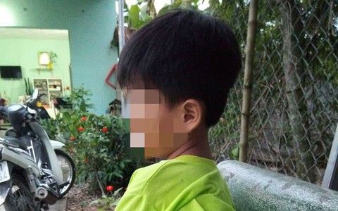 Long An: Đình chỉ cô giáo đánh học sinh bầm tím mông