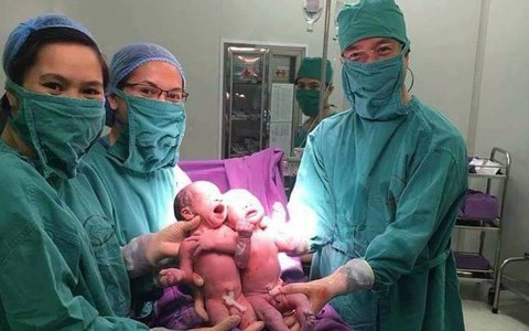 Hai bé trai được sinh cùng trứng từ thụ tinh nhân tạo tại BV Quảng Ninh
