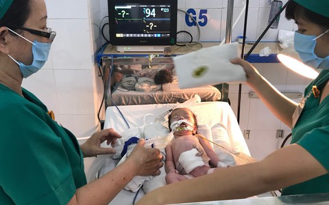 Thai phụ bất ngờ chuyển dạ trên đường xuống Sài Gòn, bé gái vừa chào đời đã bị lòi ruột ngoài ổ bụng nguy kịch