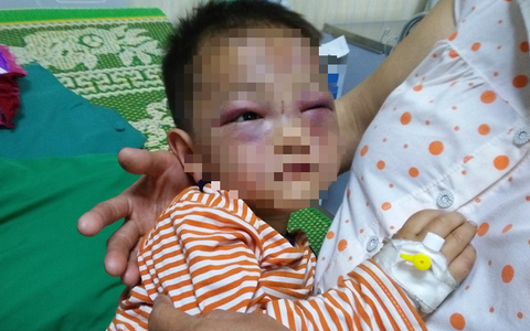 Xót cảnh bé trai 2 tuổi đẻ ra không biết mặt cha, đến khi mẹ lấy chồng thì bị cha dượng đánh đập phải nhập viện cấp cứu