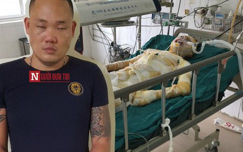 Đối tượng đốt nhân tình bỏng 95% cơ thể: Bắt cá hai tay và chuyên chăn dắt “đào”