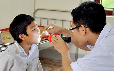 Viêm họng do liên cầu khuẩn: Dùng thuốc thế nào?