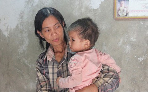 Chồng gặp nạn do xe tải kéo lê, con bệnh tim bẩm sinh và nghị lực phi thường của người phụ nữ xứ Nghệ
