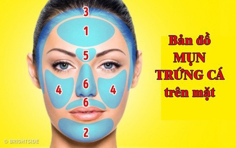 Nhìn "bản đồ mụn trứng cá" trên mặt để biết bộ phận nào trong cơ thể bạn đang gặp rắc rối
