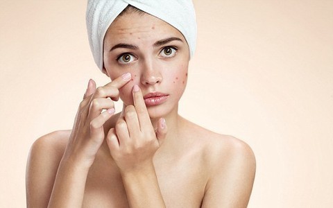 Chuyên gia ăn kiêng tiết lộ những loại đồ ăn khiến da nổi mụn
