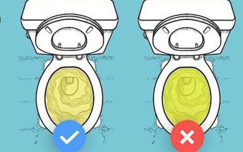 6 dấu hiệu cảnh báo bệnh ung thư bàng quang mà bạn không nên bỏ qua