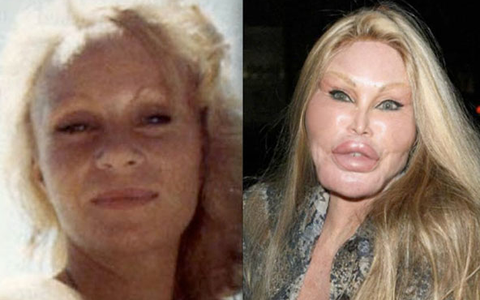 Cuộc đời tai tiếng của “miêu nữ” tỷ phú Jocelyn Wildenstein: Chi núi tiền phẫu thuật giống mèo để chiều chồng, cuối cùng nhận về kết cục đắng ngắt