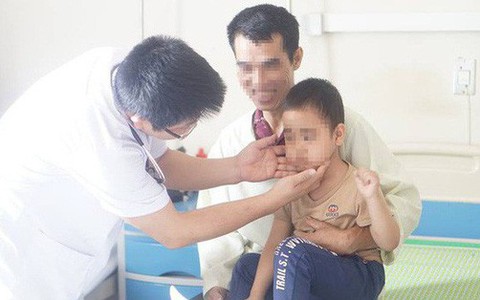Uống "thần dược" chữa ho, bé 5 tuổi ở Sơn La bị lông mọc khắp mặt