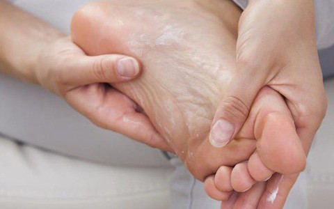 Không chỉ mùa đông, mùa hè bạn cũng có thể bị tróc da tay chân và đây là lý do