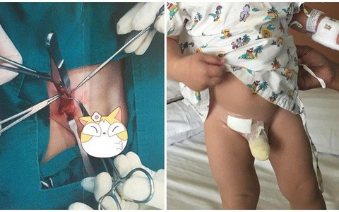 Thấy con có khối u nhỏ ở háng nhưng mẹ không bận tâm, đưa con đi khám nghe bác sĩ nói mẹ mới hốt hoảng