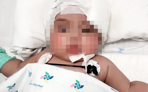 Phòng khám tư chẩn đoán nhầm viêm màng não là sốt siêu vi, bé gái 6 tháng tuổi rơi vào nguy kịch