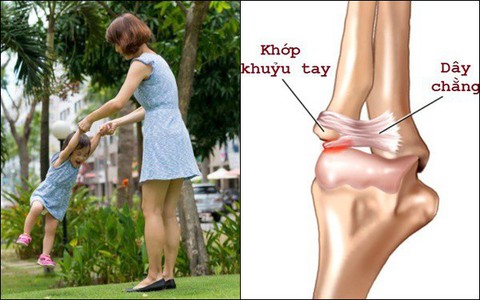 Cha mẹ còn cầm tay con theo kiểu này, đề phòng trật khớp tay con